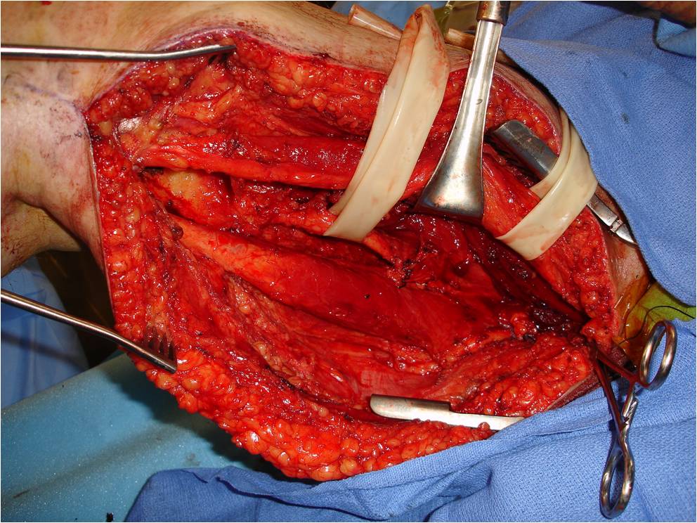 How Long Do Cats Live With Bone Cancer Metastatic Stage